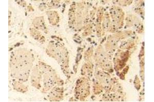 Immunohistochemistry (IHC) image for anti-Heat Shock 70kDa Protein 1A (HSPA1A) (AA 1-641) antibody (ABIN7433138)