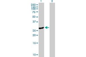 Western Blot analysis of DNAJC27 expression in transfected 293T cell line by DNAJC27 MaxPab polyclonal antibody. (DNAJC27 抗体  (AA 1-273))