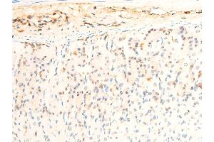 ABIN6267072 at 1/100 staining mouse intestinal tissue sections by IHC-P.