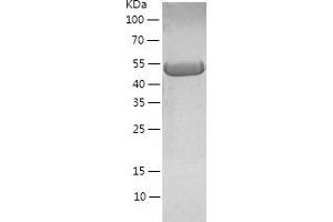 Western Blotting (WB) image for Guanine Deaminase (GDA) (AA 1-454) protein (His tag) (ABIN7289206) (GDA Protein (AA 1-454) (His tag))