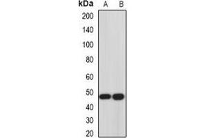 Western blot analysis of Hemojuvelin expression in Hela (A), PC3 (B) whole cell lysates. (HFE2 抗体)