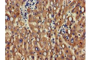 Immunohistochemistry of paraffin-embedded human liver tissue using ABIN7147124 at dilution of 1:100 (CD166 抗体  (AA 28-516))