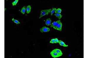 Immunofluorescent analysis of HepG2 cells using ABIN7150025 at dilution of 1:100 and Alexa Fluor 488-congugated AffiniPure Goat Anti-Rabbit IgG(H+L) (DDR2 抗体  (AA 447-540))