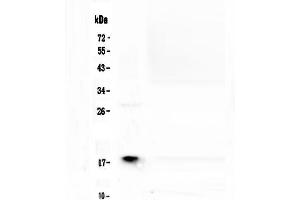 Western blot analysis of MAX using anti-MAX antibody . (MAX 抗体  (AA 30-106))