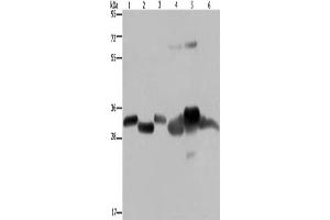Western Blotting (WB) image for anti-3-Hydroxymethyl-3-Methylglutaryl-CoA Lyase (HMGCL) antibody (ABIN2430231) (HMGCL 抗体)
