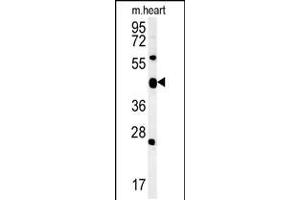 Western blot analysis in mouse heart tissue lysates (15ug/lane). (ACSF3 抗体  (AA 413-442))