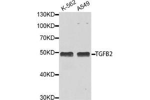 Western blot analysis of extracts of various cell lines, using TGFB2 antibody. (TGFB2 抗体  (AA 20-160))