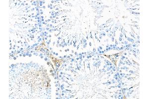 ABIN7094554 and ABIN7098603 at 1/100 staining Rat testis tissue by IHC-P. (DNASE2 抗体  (Internal Region))