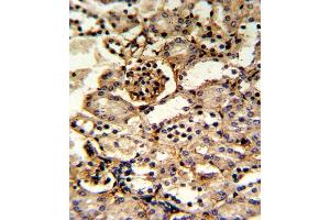 Formalin-fixed and paraffin-embedded kidney tissue reacted with GS Antibody (Center), which was peroxidase-conjugated to the secondary antibody, followed by DAB staining. (GMP Synthase 抗体  (AA 296-325))