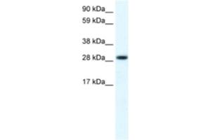 Western Blotting (WB) image for anti-Four and A Half LIM Domains 1 (FHL1) antibody (ABIN2460931) (FHL1 抗体)