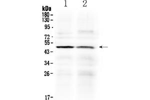 Western blot analysis of HtrA3 using anti- HtrA3 antibody . (HTRA3 抗体  (C-Term))