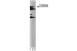 Western blot analysis of PI3-Kinase p110delta on a rat cerebrum lysate. (PIK3CD 抗体  (AA 73-90))