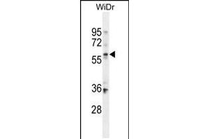 Western blot analysis in WiDr cell line lysates (35ug/lane). (BCMO1 抗体  (AA 263-292))