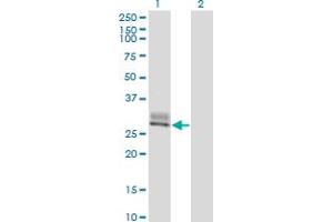 Western Blot analysis of SPINT2 expression in transfected 293T cell line by SPINT2 monoclonal antibody (M01), clone 2D1. (SPINT2 抗体  (AA 1-253))