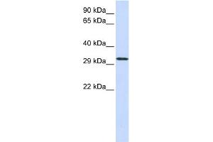 WB Suggested Anti-C21orf2 Antibody Titration:  0.