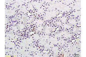 Formalin-fixed and paraffin embedded rat brain tissue labeled with Anti phospho-MAP3K9+MAP3K10(Thr312+Thr266) Polyclonal Antibody, Unconjugated (ABIN872294) at 1:200 followed by conjugation to the secondary antibody and DAB staining (MAP3K9 抗体  (pThr312))