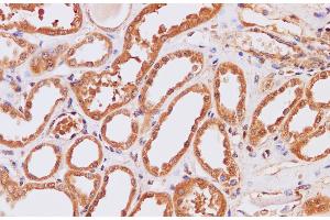 Immunohistochemistry of paraffin-embedded Human kidney using ITPKB Polyclonal Antibody at dilution of 1:200 (ITPKB 抗体)