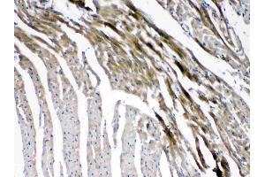 IHC analysis of Connexin 45/GJA7 using anti- Connexin 45/GJA7 antibody .