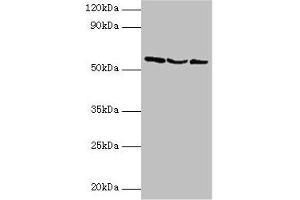 Western blot All lanes: USP14 antibody at 2 μg/mL Lane 1: Hela whole cell lysate Lane 2: 293T whole cell lysate Lane 3: NIH/3T3 whole cell lysate Secondary Goat polyclonal to rabbit IgG at 1/10000 dilution Predicted band size: 57, 53, 55 kDa Observed band size: 57 kDa (USP14 抗体  (C-Term))