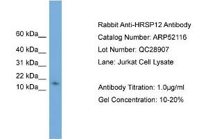 WB Suggested Anti-HRSP12  Antibody Titration: 0. (HRSP12 抗体  (N-Term))