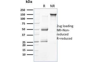 SDS-PAGE Analysis Purified Cytokeratin 15 Mouse Monoclonal Antibody (SPM190). (KRT15 抗体  (C-Term))