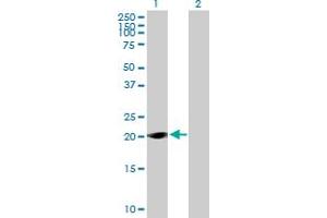 Western Blot analysis of LOC285697 expression in transfected 293T cell line by LOC285697 MaxPab polyclonal antibody. (TAF11L1 抗体  (AA 1-183))