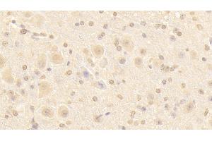 Detection of NUP133 in Mouse Cerebellum Tissue using Polyclonal Antibody to Nucleoporin 133 (NUP133) (NUP133 抗体  (AA 36-240))