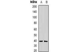 Western blot analysis of CABP1 expression in mouse brain (A), rat brain (B) whole cell lysates. (CABP1 抗体)