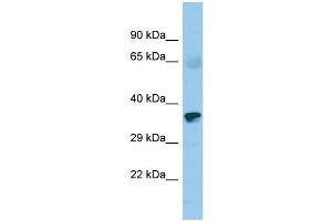 Host: Rabbit Target Name: ZNF330 Sample Type: Fetal Heart lysates Antibody Dilution: 1. (ZNF330 抗体  (C-Term))