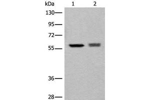 Western blot analysis of EPG2 and Jurkat cell lysates using ATL3 Polyclonal Antibody at dilution of 1:800 (ATL3 抗体)