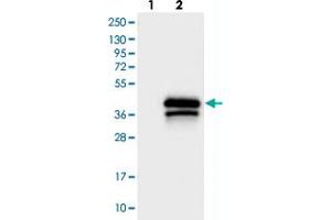 Western blot analysis of Lane 1: Negative control (vector only transfected HEK293T lysate), Lane 2: Over-expression Lysate (Co-expressed with a C-terminal myc-DDK tag (~3. (TREML1 抗体)
