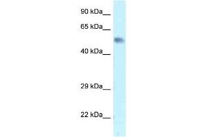 WB Suggested Anti-Zfp472 Antibody   Titration: 1. (Zfp472 抗体  (N-Term))