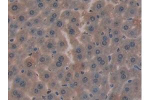 Detection of CYR61 in Mouse Liver Tissue using Polyclonal Antibody to Cysteine Rich Protein, Angiogenic Inducer 61 (CYR61) (CYR61 抗体  (AA 176-379))