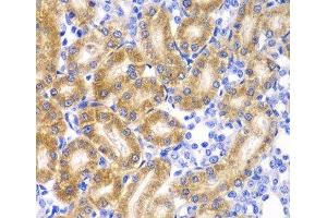 Immunohistochemistry of paraffin-embedded Rat kidney using RPN1 Polyclonal Antibody at dilution of 1:100 (40x lens). (RPN1 抗体)
