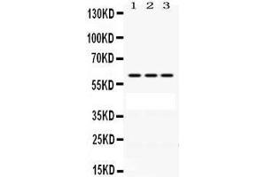 Western Blotting (WB) image for anti-Protection of Telomeres 1 (POT1) (AA 195-234), (N-Term) antibody (ABIN3043444) (POT1 抗体  (N-Term))