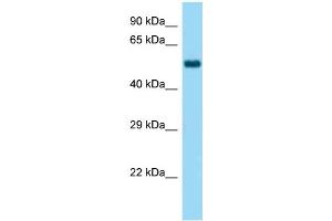 Western Blotting (WB) image for anti-Wolf-Hirschhorn Syndrome Candidate 2 (WHSC2) (C-Term) antibody (ABIN972009) (WHSC2 抗体  (C-Term))