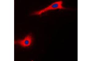Immunofluorescent analysis of CABC1 staining in HeLa cells. (COQ8A 抗体  (Center))