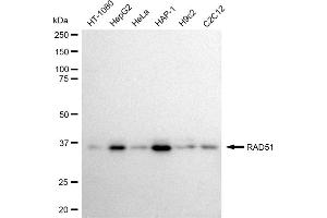 Western blotting analysis using RAD51 antibody (ABIN7798366).