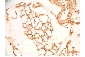 Mouse visceral fat tissue was stained by Rabbit Anti-SFRP-2 S (25-50) (Human) Antiserum (SFRP2 抗体  (AA 25-50))