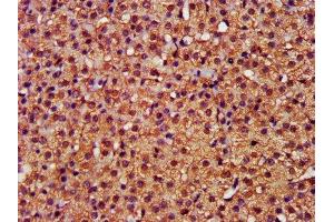 Immunohistochemistry (IHC) image for anti-CASP8 and FADD-Like Apoptosis Regulator (CFLAR) (AA 1-250) antibody (ABIN7146901)