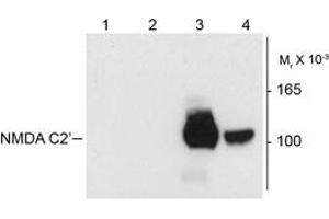 Image no. 1 for anti-NMDA Receptor 1 (NMDA R1) (Splice Variant C2') antibody (ABIN372677) (NMDA 1 Receptor 抗体  (Splice Variant C2'))