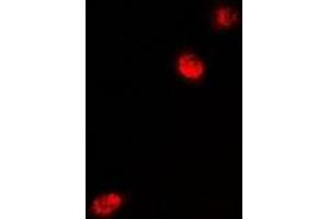 Immunofluorescent analysis of MeCP2 staining in U2OS cells. (MECP2 抗体)