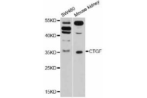 Western blot analysis of extracts of various cell lines, using CTGF antibody (ABIN5997530) at 1/1000 dilution. (CTGF 抗体)
