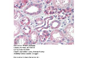 Immunohistochemistry with Human kidney lysate tissue at an antibody concentration of 5. (TRIM68 抗体  (Middle Region))