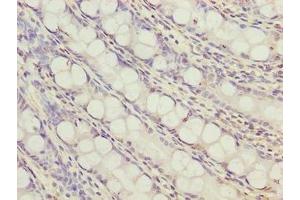 Immunohistochemistry of paraffin-embedded human colon tissue using ABIN7166380 at dilution of 1:100 (ZNF767P 抗体  (AA 1-118))