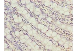 Immunohistochemistry of paraffin-embedded human colon tissue using ABIN7166380 at dilution of 1:100