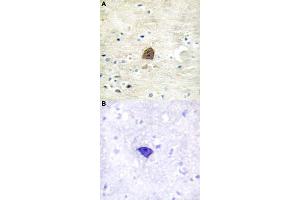 Immunohistochemical staining (Formalin-fixed paraffin-embedded sections) of human brain tissue with CAMK2A/CAMK2B/CAMK2D (phospho T305) polyclonal antibody  without blocking peptide (A) or preincubated with blocking peptide (B) under 1:50-1:100 dilution. (CAMK2A 抗体  (pThr305))