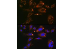 Immunofluorescence analysis of U-2 OS cells using ACLY Rabbit mAb (ABIN1678575, ABIN7101559, ABIN7101560 and ABIN7101561) at dilution of 1:100 (40x lens). (ACLY 抗体)