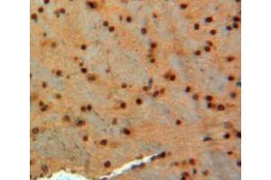 IHC-P analysis of brain tissue, with DAB staining. (GAD 抗体  (AA 1-97))