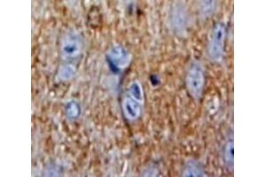 Used in DAB staining on fromalin fixed paraffin-embedded Brain tissue (SOD4 抗体  (AA 17-270))